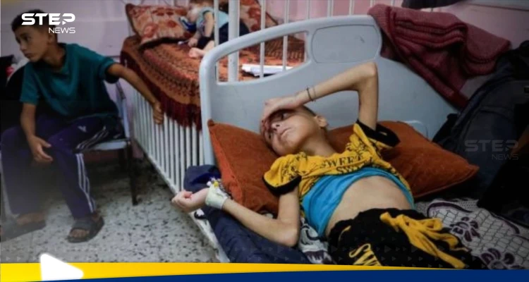 الصحة العالمية تكشف عدد الأشخاص الذين ماتوا بسبب سوء التغذية في غزة هذا العام