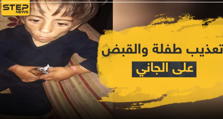 بالصور|| طفلة تتعرض لأبشع أنواع التعذيب على يد والدها والمعارضة السورية تقبض عليه