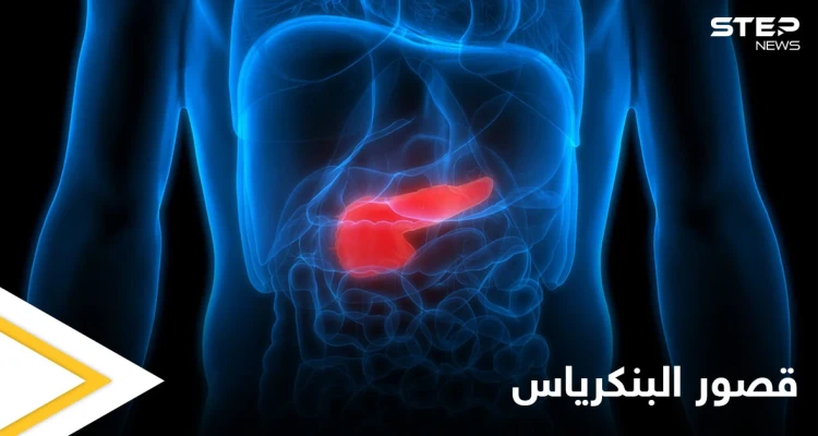 خطورة قصور البنكرياس وآثاره الصحية وطرق العلاج إليك أهم المعلومات