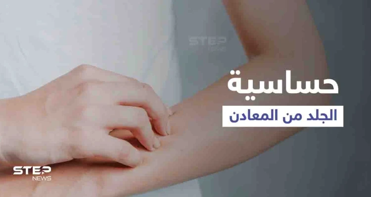 ما هي حساسية الجلد من المعادن وأهم أعراضها وطرق العلاج