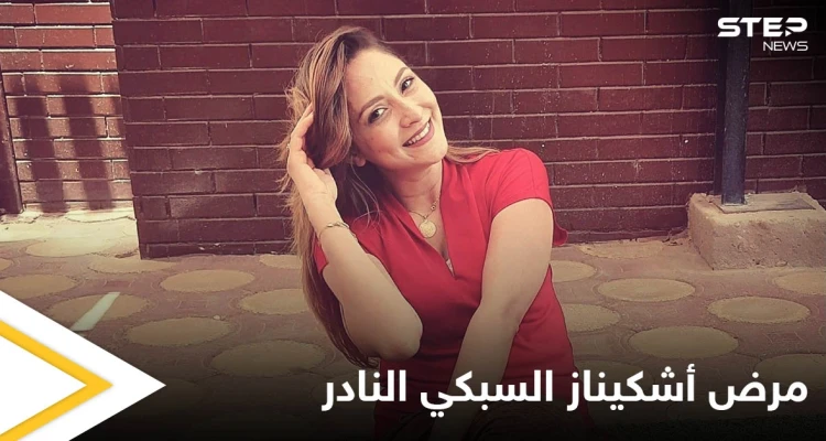 تنبأت بوفاتها وودعت محبيها بكلمات مؤثرة.. حقيقة المرض النادر الذي أنهى حياة البلوجر أشكيناز السبكي