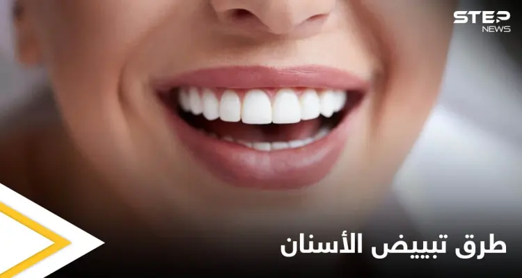 تبييض الأسنان في المنزل وأبرز أنواعه الطبية: أخبار