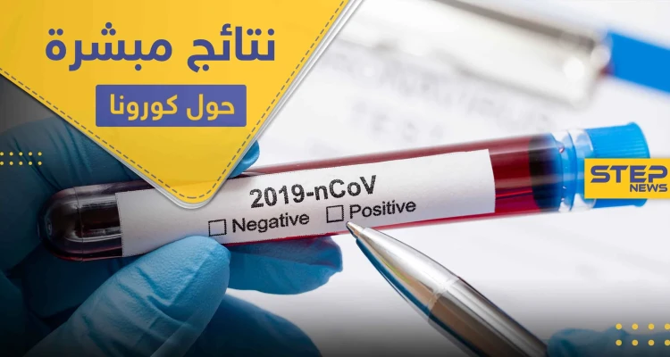 العلماء يتوصلون لنتيجة مبشرة حول كورونا .. والدواء