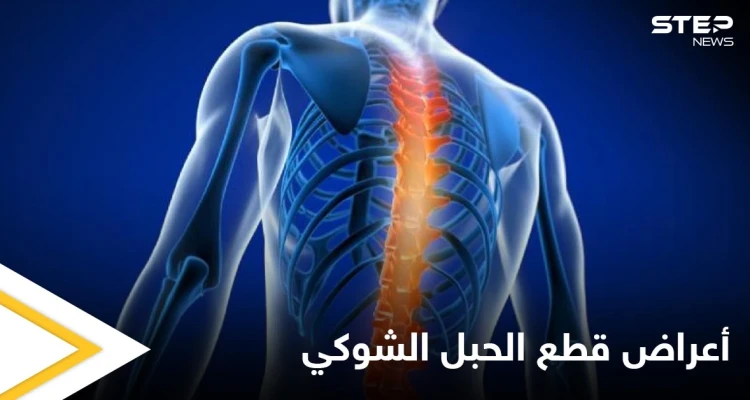 تعرف على أنواع وأعراض قطع الحبل الشوكي وطرق العلاج