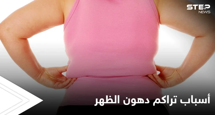 تعرف على أسباب تراكم دهون الظهر وطرق بسيطة للتخلص منها