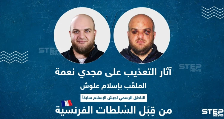 آثار التعذيب على مجدي نعمة الملقب بـ "إسلام علوش" من قبل السلطات الفرنسية
