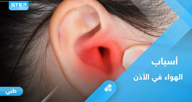 هل شعرت يوماً بـ "هواء في الأذن".. إليك الأسباب وطرق العلاج