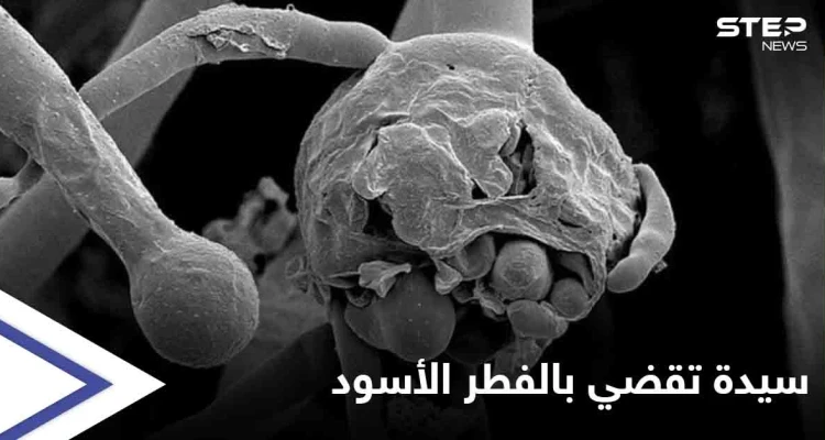 وفاة أول سيدة عربية يشتبه بإصابتها بـ الفطر الأسود