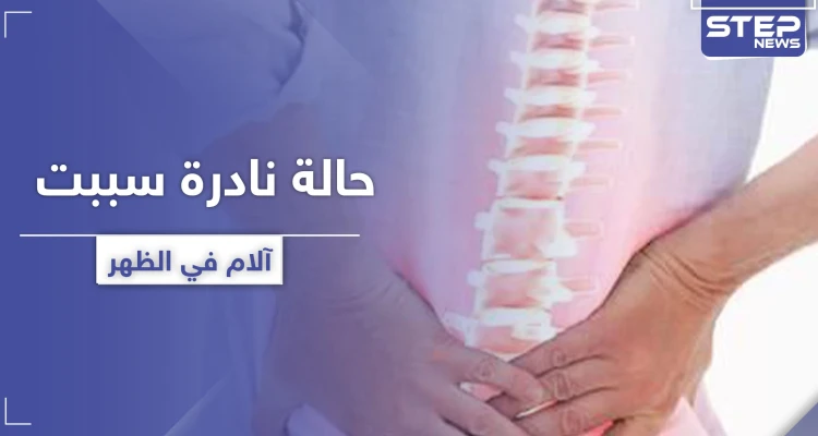 سببت آلام في الظهر.. حالة نادرة لرجل تدهش الأطباء