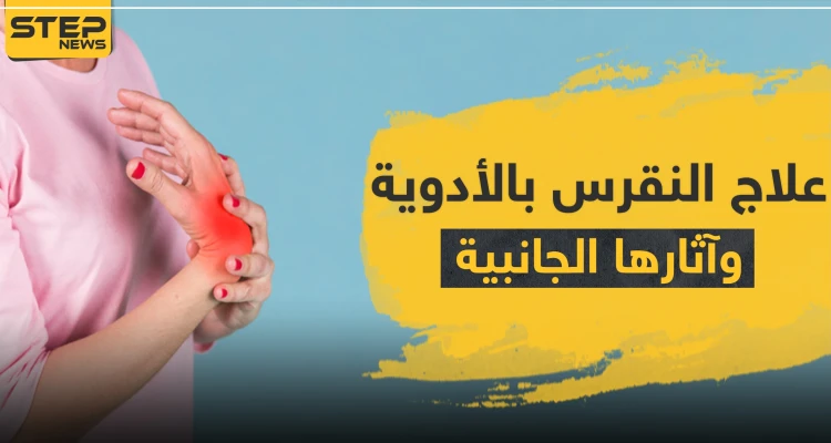 علاج النقرس بالأدوية وآثارها الجانبية