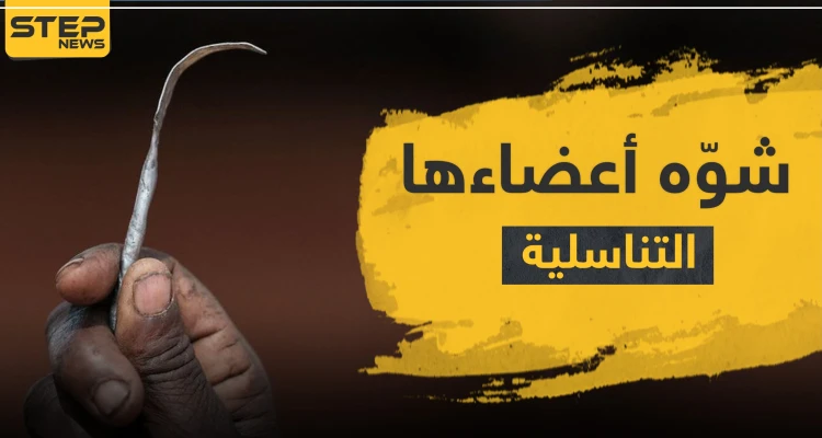 شوه أعضاءها التناسلية بعملية ختان.. طبيب مصري أمام المحكمة