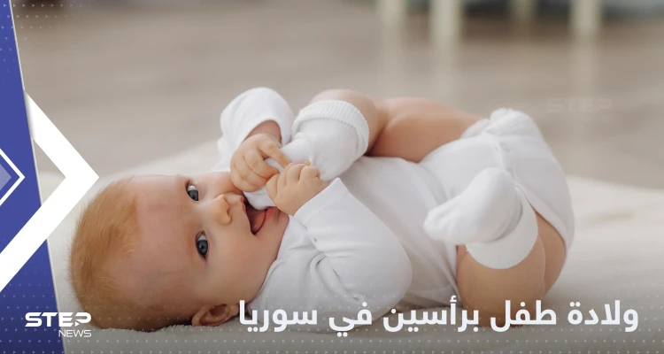 شاهد|| حالة طبية نادرة.. ولادة طفل برأسين في إدلب شمال سوريا