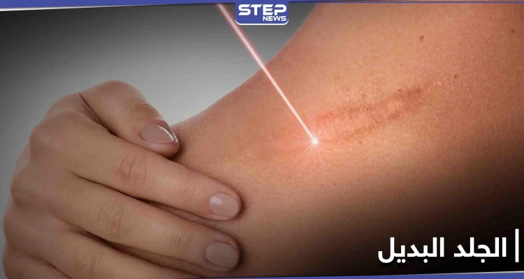 مسدس طبي.. اختراق يولد جلداً بديلاً ويغطي الحروق