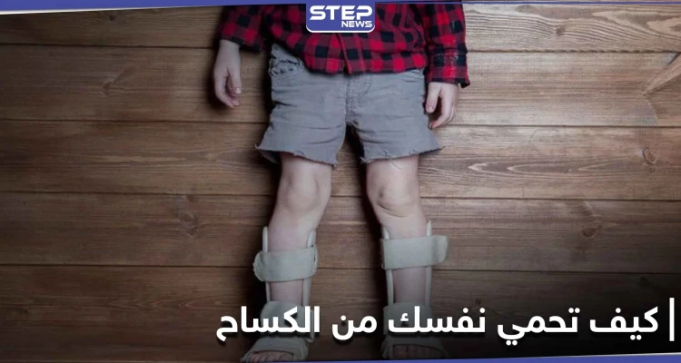 لين العظام.. كيف تحمي نفسك وأطفالك من خطر الإصابة بالكساح؟