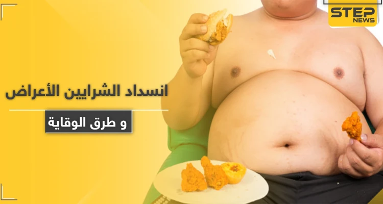 الأعراض الخفية التي تنبئ بانسداد الشرايين .. ومخاطرها وطرق الوقاية منها