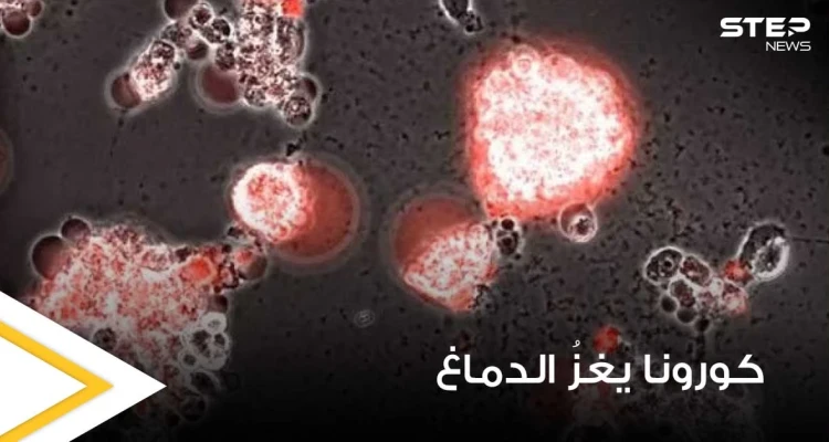 بالفيديو|| في تصوير نادر.. فيديو يوثق كيف يغزو فيروس كورونا خلايا الدماغ