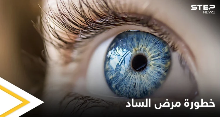 أكثر أمراض العين خبثاً.. ما هو مرض الساد وماهي أسبابه إليك التفاصيل