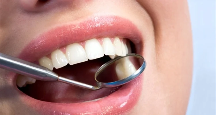 تجميل اللثة.. 4 أنواع رئيسي للعملية مع كافة التفاصيل والتكلفة والنصائح