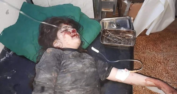 صور للقصف و الجرحى في بلدة كفرعويد بجبل الزاوية في ريف إدلب .