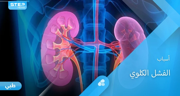 أسباب الفشل الكلوي المزمن وأفضل طرق العلاج إليك أهم المعلومات