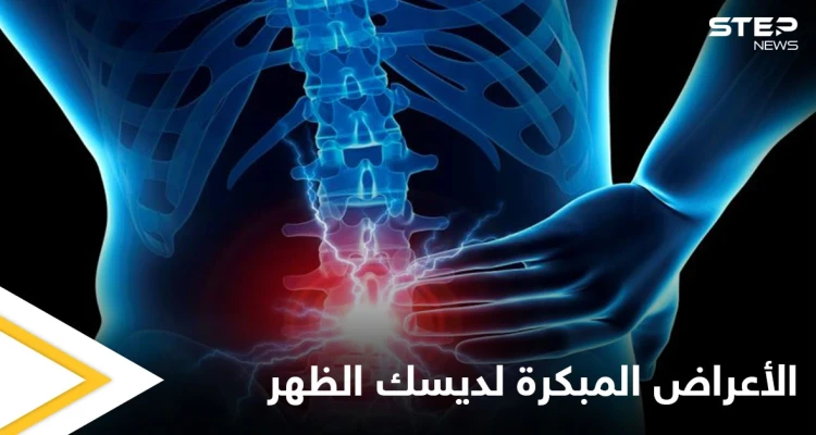 من أمراض العصر.. ديسك الظهر إليك أعراضه المبكرة وطرق علاجه