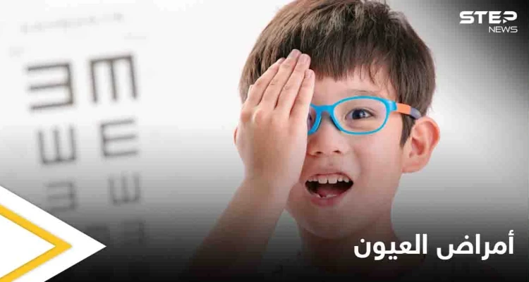تعرف على أمراض العيون الشائعة لدى الأطفال في المراحل المبكرة وطرق علاجها