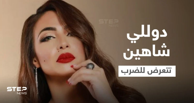 دوللي شاهين تتعرض للضرب المبرح وتنشر صور الكدمات التي ظهرت على وجهها وجسدها ومدير أعمالها يوضح (صور)