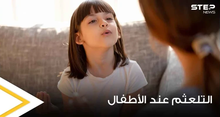 التلعثم عند الأطفال "التأتأة".. ما أسبابه وما هي طرق علاجه