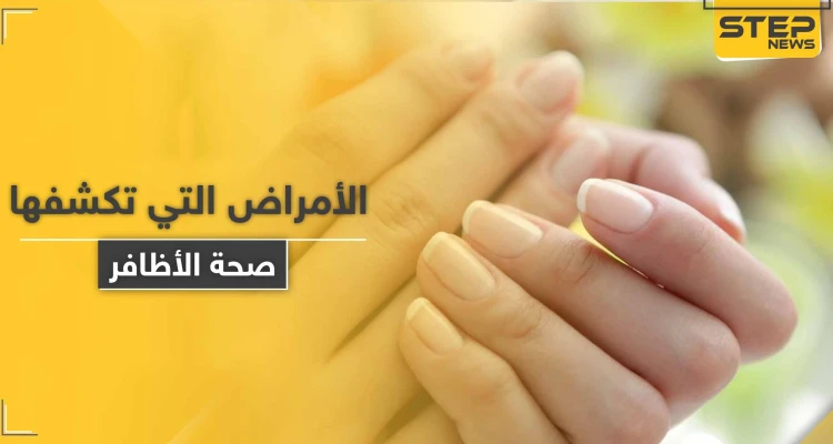 ما الأمراض التي تكشفها صحة الأظافر وألوانها وأشكالها في جسم الإنسان