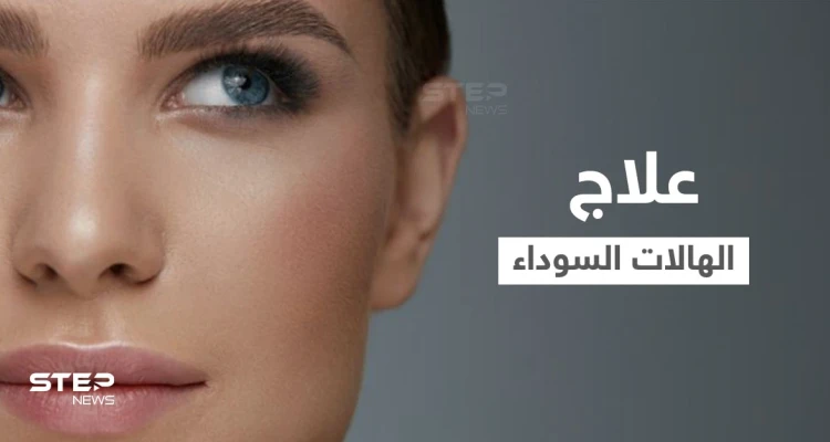علاج الهالات السوداء "ازرقاق تحت العين" في المنزل وبطرق طبية إليك أهم المعلومات