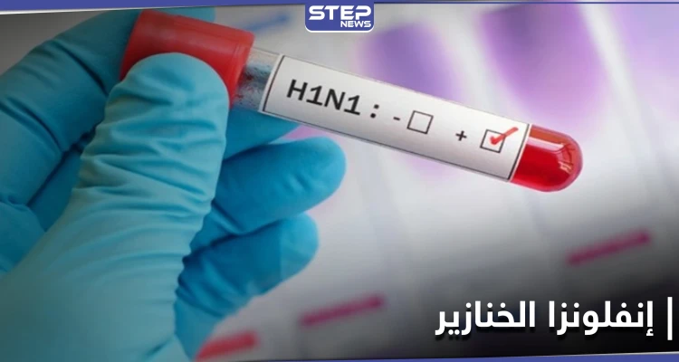 كندا تسجل أوّل حالة إصابة بمرض إنفلونزا الخنازير النادر تزامناً مع ارتفاع إصابات كورونا
