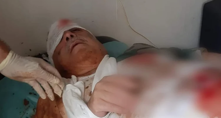 إصابة المسؤول الأول عن مجزرة البيضا بجراح بالغة نتيجة عبوة ناسفة!!