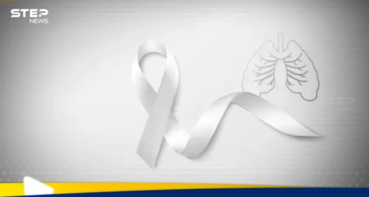 دراسة علمية تكشف سر انتشار سرطان الرئة لدى غير المدخنين