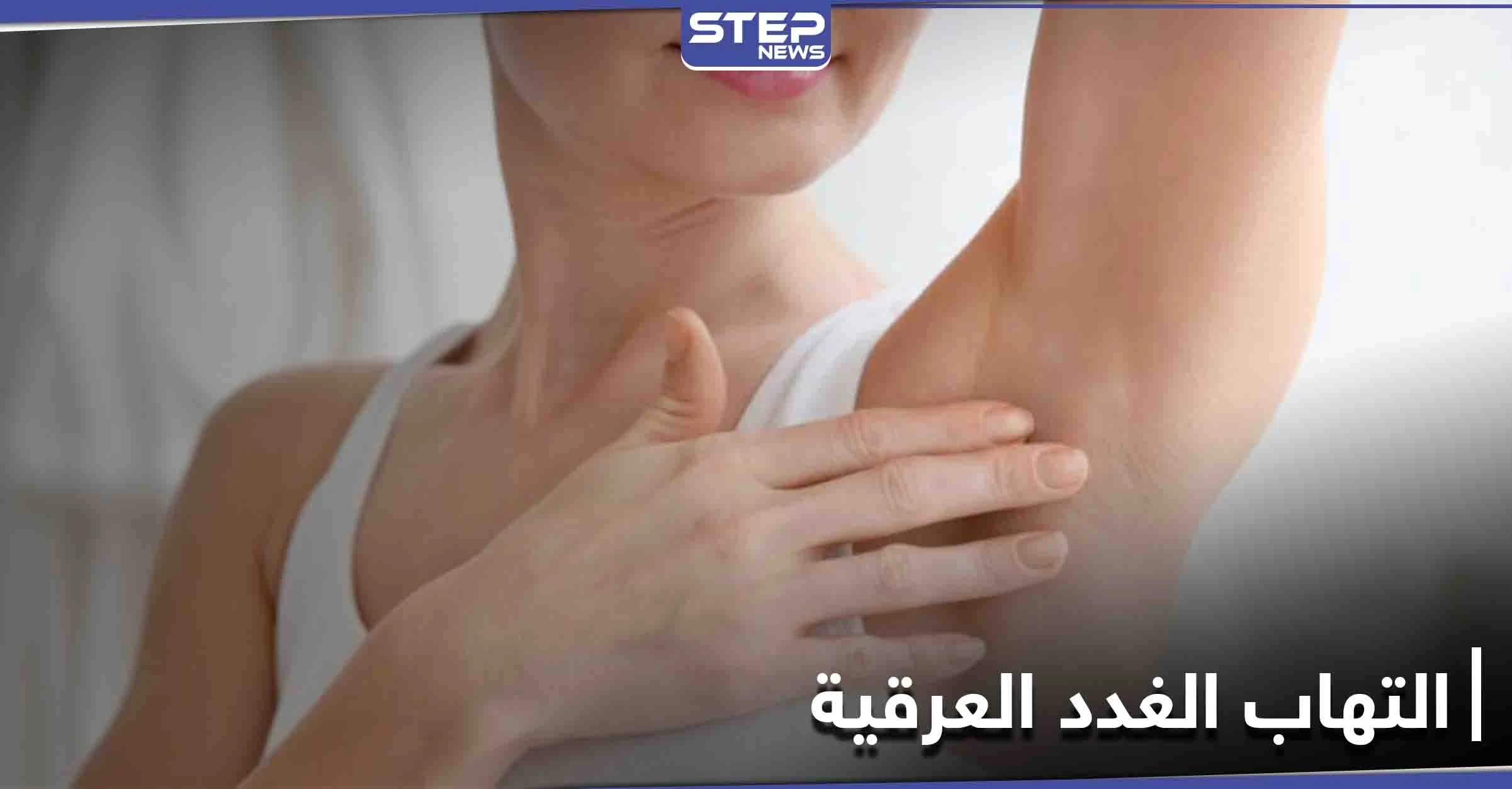 متى يحتاج التهاب الغدد العرقية إلى الجراحة تعرف إلى أعراضه وطرق العلاج
