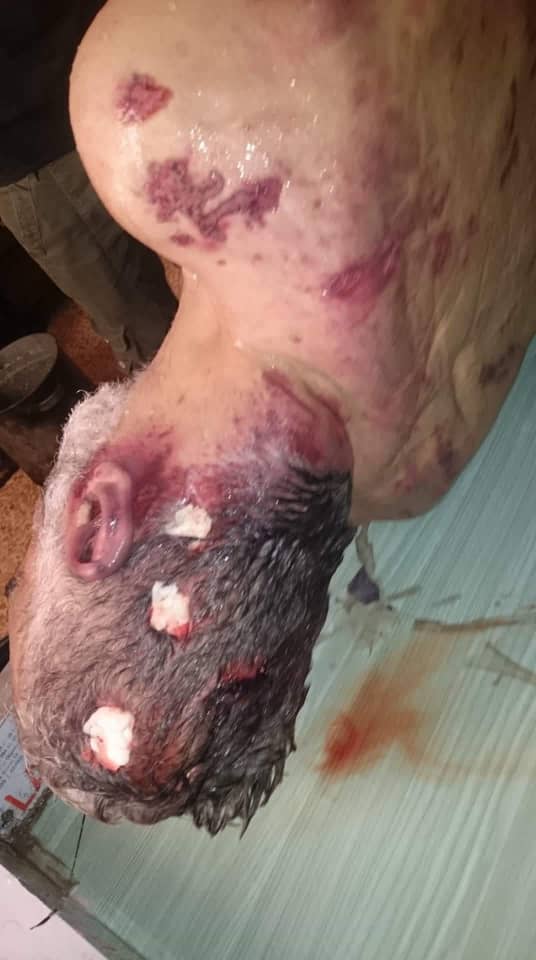 بالصور: مقتل رجل تحت التعذيب بسجون هيئة تحرير الشام 
