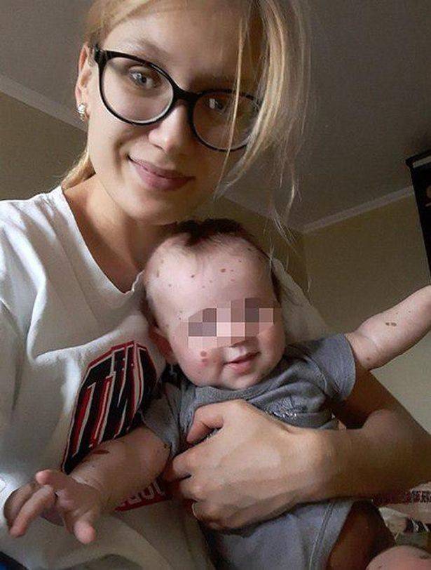 كاهن روسي يرفض "تعميد" طفلة صغيرة لسببٍ في جسدها (صور)