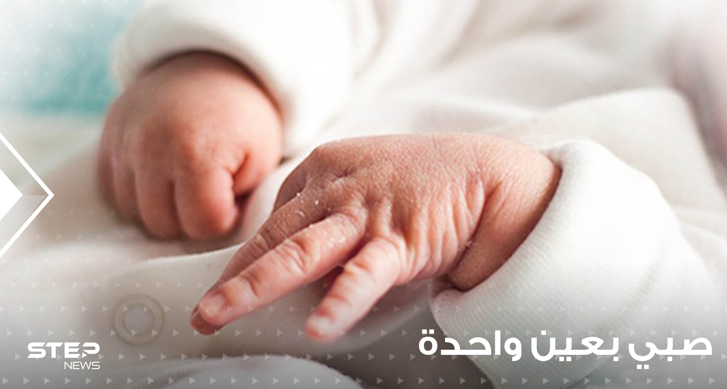 شاهد|| بحالة غريبة.. مدينة عربية تشهد ولادة نادرة لصبي بعين واحدة