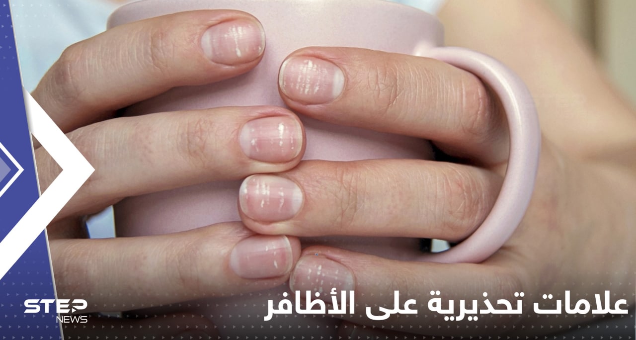 4 علامات تظهر على اليد قد تشير إلى إصابتك بـ مرض السكري لا تتجاهلها